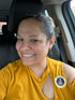 Sarah’s testimonial showing clear, calm skin after using Epicderma Face & Scalp Elixir
