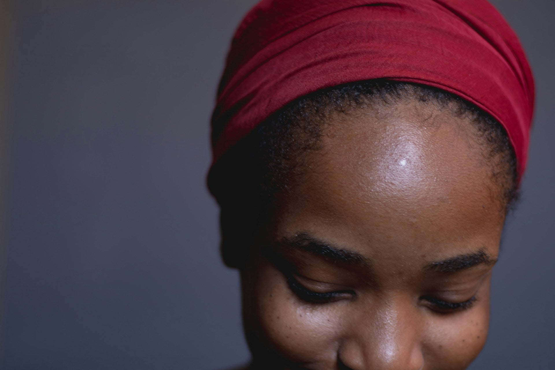 Black Skin Fungal Skin photo