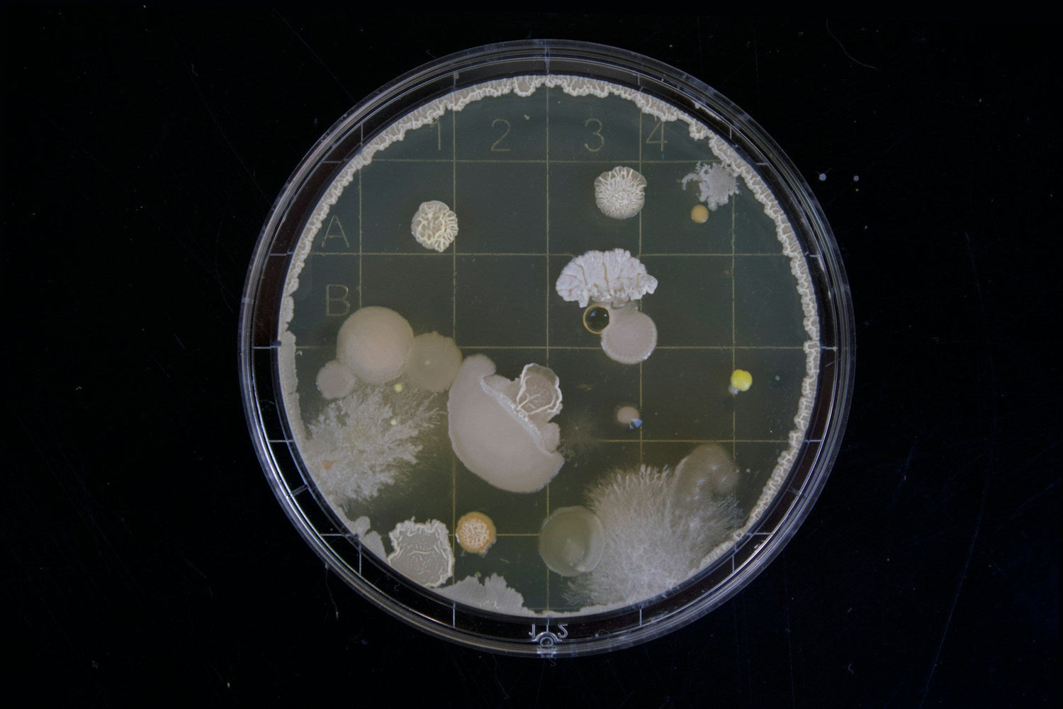 fungi under microscope