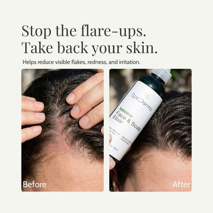 Face and Scalp Elixir