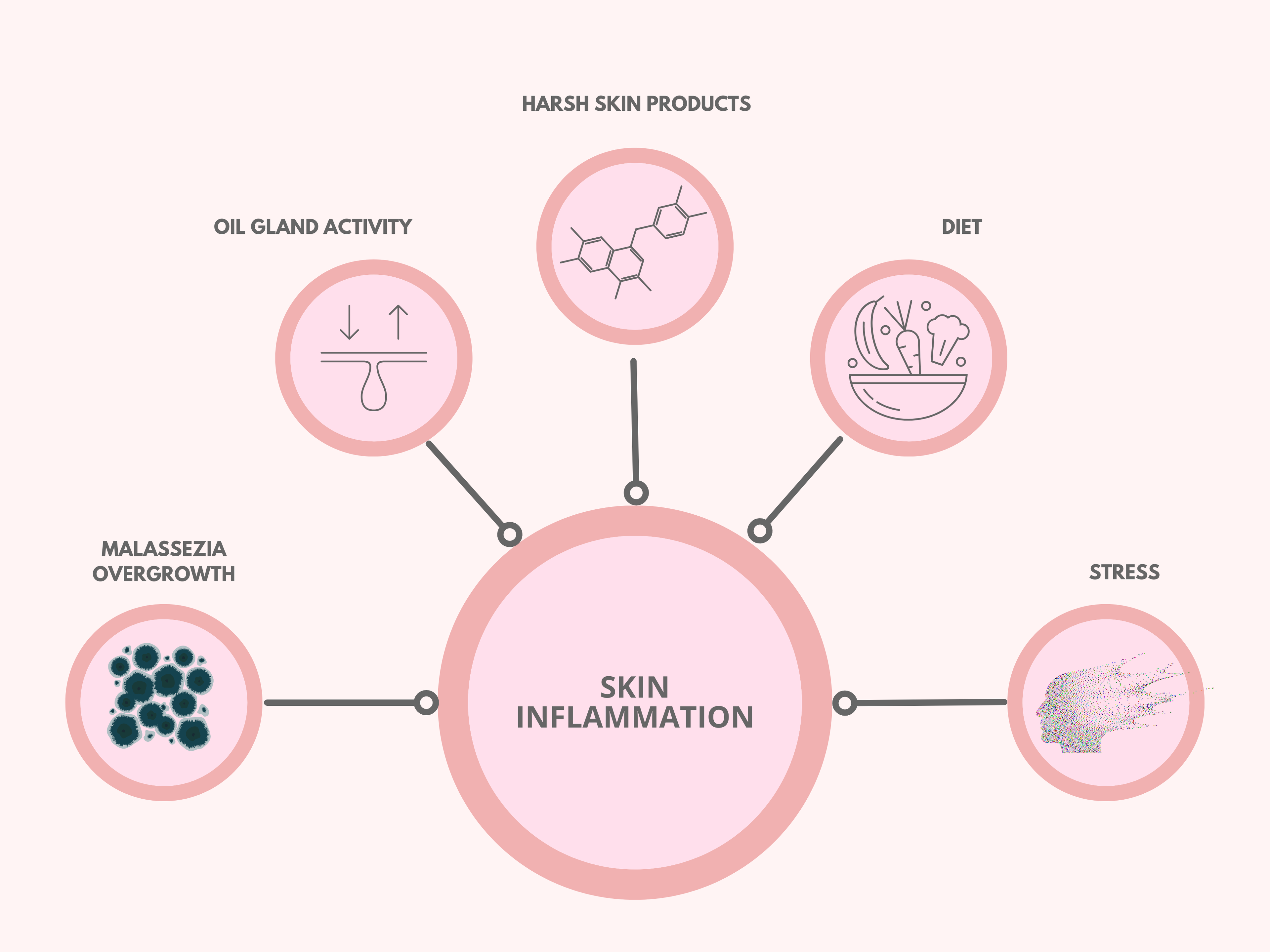 Infographic: botanical solutions targeting Malassezia overgrowth—Epicderma antifungal formula