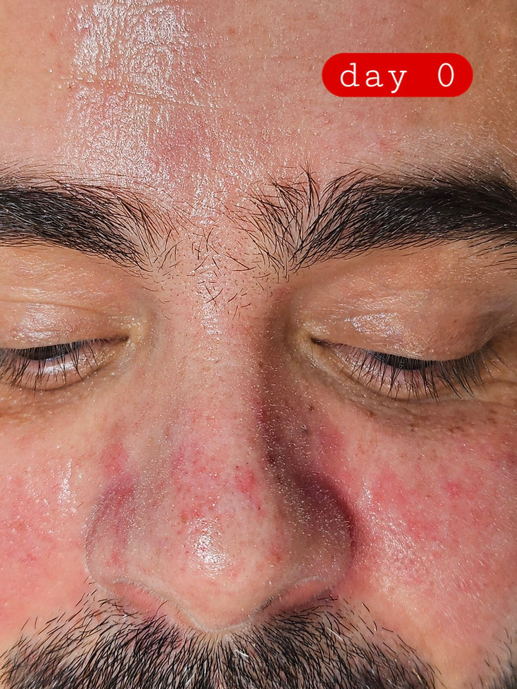 Graphic “Change your skin, change your life” – Epicderma brand motto inviting transformation